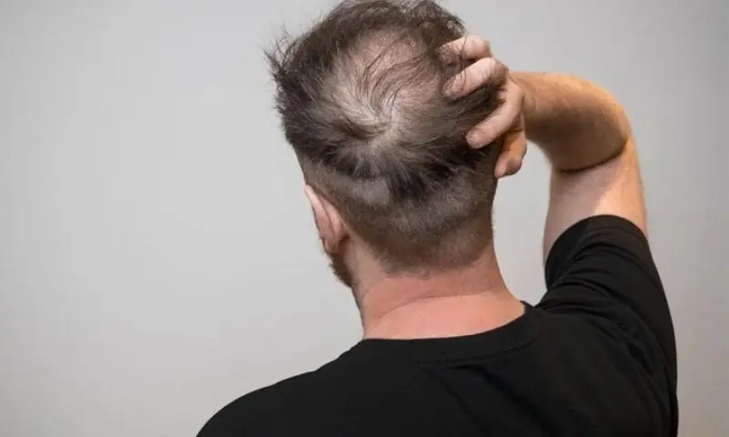 &mdash;شٹراسٹاک