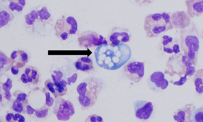 An image of the Naegleria Fowleri amoeba. &mdash; US Centres for Disease Control