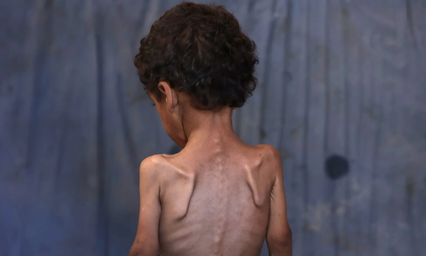   Yazan, a malnourished 2-year-old, stands in his family’s damaged home in the Al-Shati refugee camp west of Gaza City on July 23. — AFP  