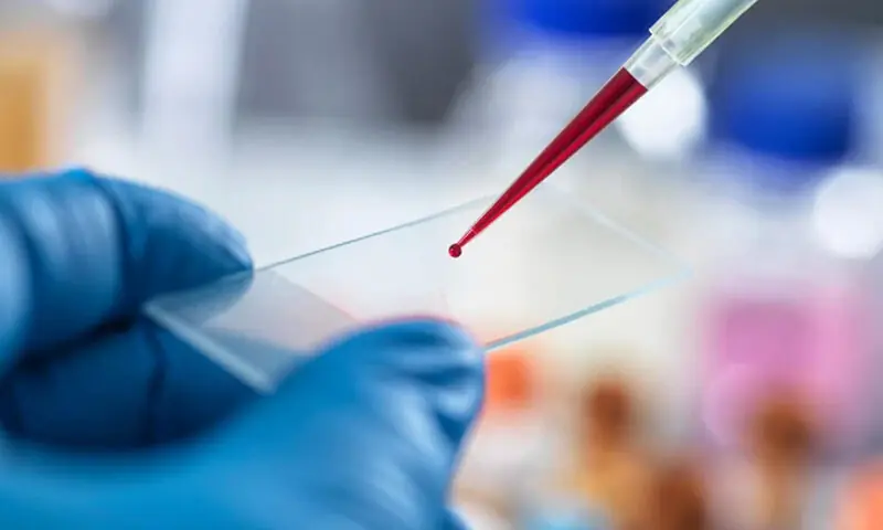 &mdash;فوٹو: TEK Image