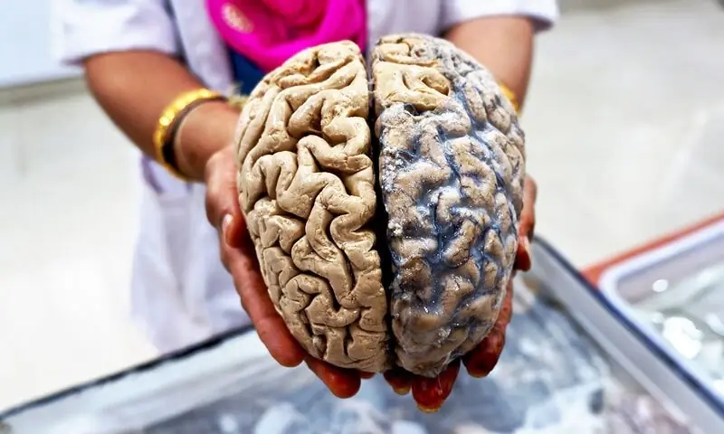 &mdash;فوٹو: ایٹلس آبسٹریکا