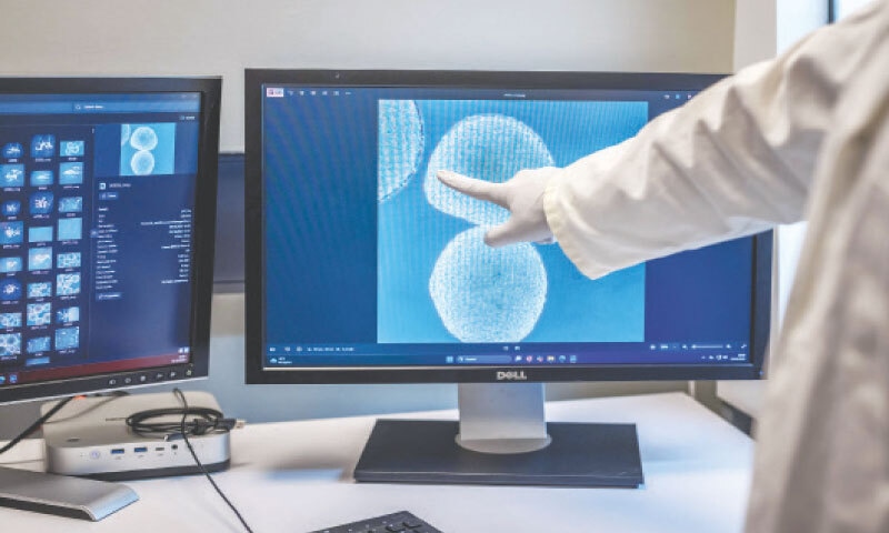 A SCREEN showing human brain cells at FinalSpark, a Swiss start-up.&mdash;AFP