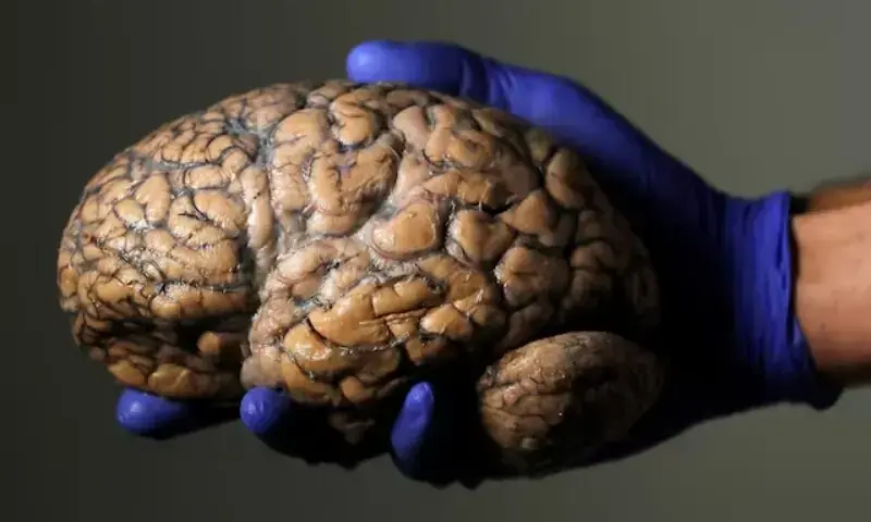 A researcher holds a human brain, part of a collection of more than 3,000 brains at the psychiatric hospital in Duffel, Belgium, July 19, 2017. &mdash; Reuters