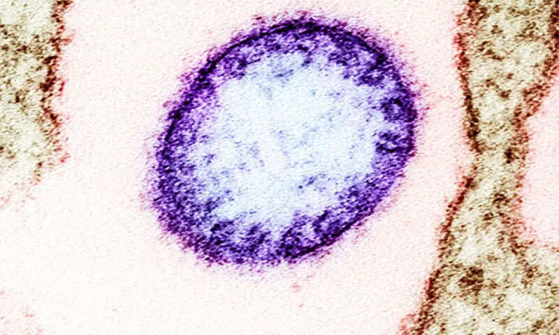 An image of a Nipah virus particle. &mdash; Harvard Medical School
