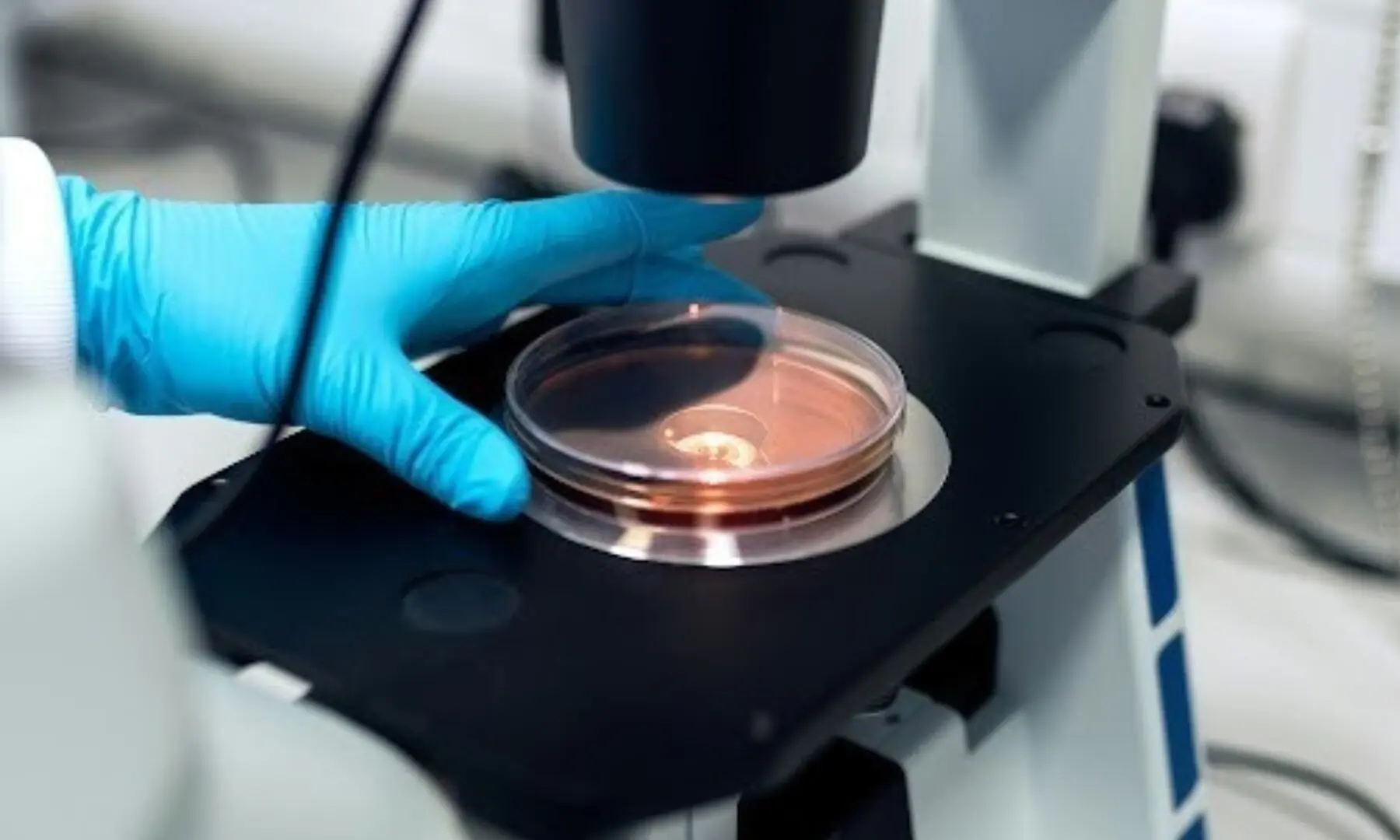 Decapeptide-12 and the architecture of targeted Melanogenesis Modulation research