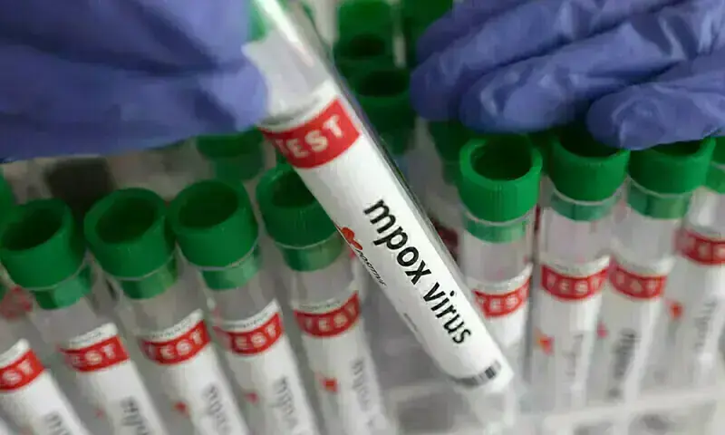 A test tube labelled "Mpox virus positive" is held in this illustration taken August 20, 2024. &mdash; Reuters/File