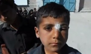 Leishmaniasis' fear grows in KP's Karak district