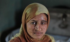 Long road to justice for acid attack survivors in India