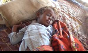 عمر کوٹ:خسرہ پھیلنے سے 10 بچے دم توڑ گئے