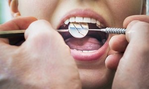 درمیانی عمر میں دانتوں کا ٹوٹنا کس مرض کی علامت؟
