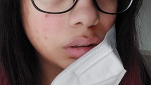 If your face mask is giving you maskne, you're not alone. Here's how to handle it