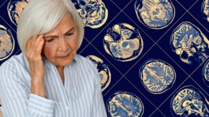 دماغی بیماری الزائمر میں خلیات کیسے ختم ہوتے ہیں؟ سائنسدانوں نے پتا لگا لیا