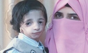 &rsquo;ٹریچر کولنز سنڈروم&lsquo; کا شکار وہاج اور اس کی باہمت والدہ کی کہانی