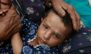 پنجاب میں خسرہ کے بڑھتے کیسز، صوبائی محکمہ صحت متحرک