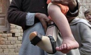 Another polio case surfaces in Pishin