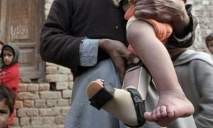 کراچی، کشمور اور ڈیرہ اسمٰعیل خان میں مزید 3 پولیو کیسز رپورٹ