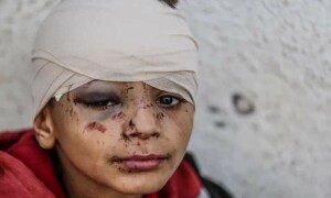 اسرائیلی بمباری سے مزید 81 فلسطینی شہید، اسکول پر حملے میں کئی بچے زندہ جل گئے