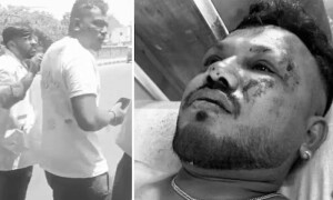ویڈیو: ایئر انڈیا حادثہ، سیٹ ’11 اے‘ کا مسافر معجزانہ طور پر زندہ بچ گیا