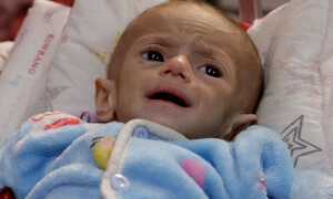 Israel continues to deny entry of baby milk into Gaza: field hospital director