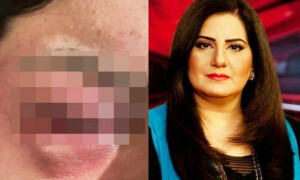 جیسمین منظور کے سابق شوہر پر تشدد کے الزامات، تصاویر شیئر کردیں