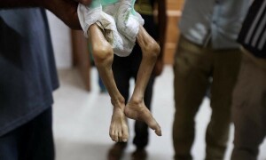 Baby dies of malnutrition in northern Gaza