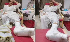 چہل قدمی کے دوران پھسلنے پر مصطفیٰ قریشی کی ٹانگ کی ہڈی ٹوٹ گئی