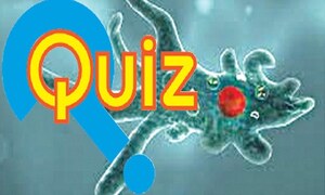 Quiz