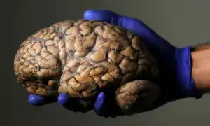 انسانی دماغ 3 دہائی تک ’نوجوانی‘ کی حالت میں رہتا ہے، نئی تحقیق میں انکشاف