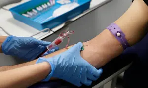 یورپ میں ایچ آئی وی کے نصف سے زائد کیسز کی تتشخیص تاخیر سے ہونے کا انکشاف