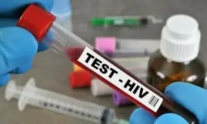 دنیا بھر میں ایچ آئی وی مریضوں کی تعداد 4 کروڑ 80 لاکھ تک پہنچ گئی