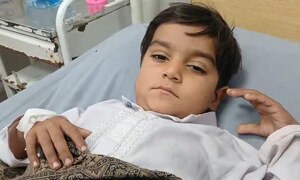 Rare &lsquo;fetus in fetu&rsquo; surgery at SZMCH