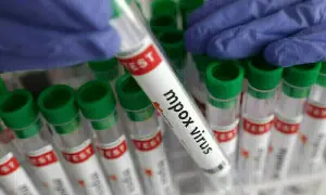 Health dept issues alert as KP records 26 mpox cases