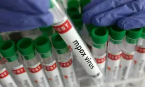 Khairpur sees mpox outbreak as seven babies test positive