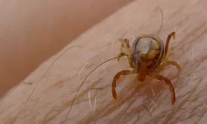 Sindh records year&rsquo;s first death from Congo fever