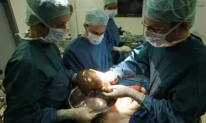 SC laments rising &lsquo;illegal organ transplants&rsquo; in Punjab