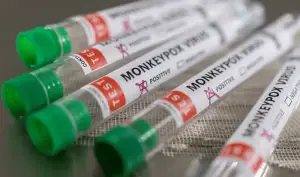 Another mpox suspected case in Bahawalpur