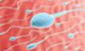 Falling sperm counts a worrying trend worldwide